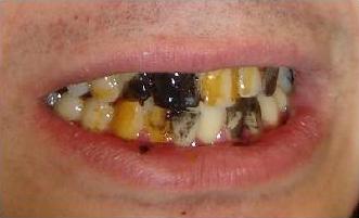 dentmanchados.jpg